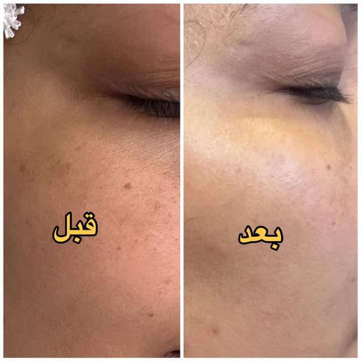 سيروم الجوجوبا وكريم فيتامين سي