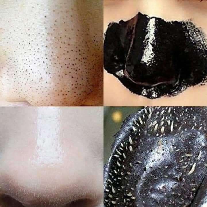 ماسك الفحم النشط