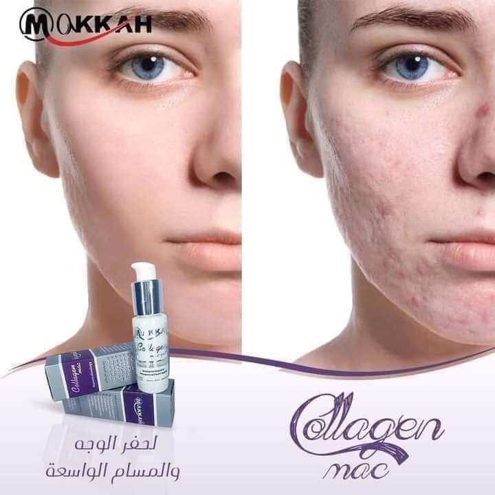 كولاجين ماك التجاعيد وكولاجين ماك التجاعيد وعلاج الخطوط التعبريه