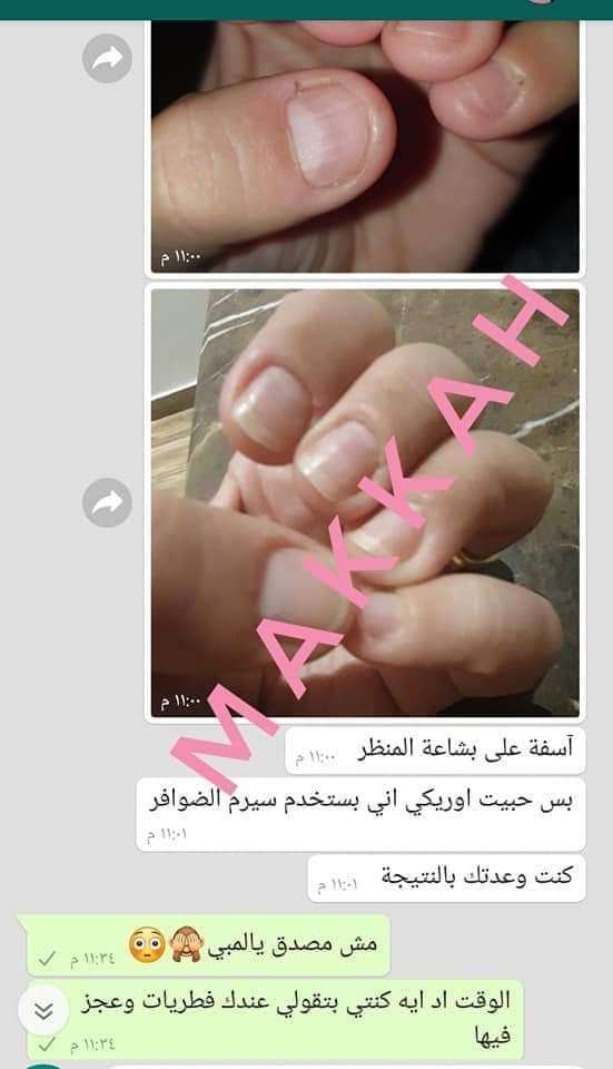 سيرم تقويه الاظافر