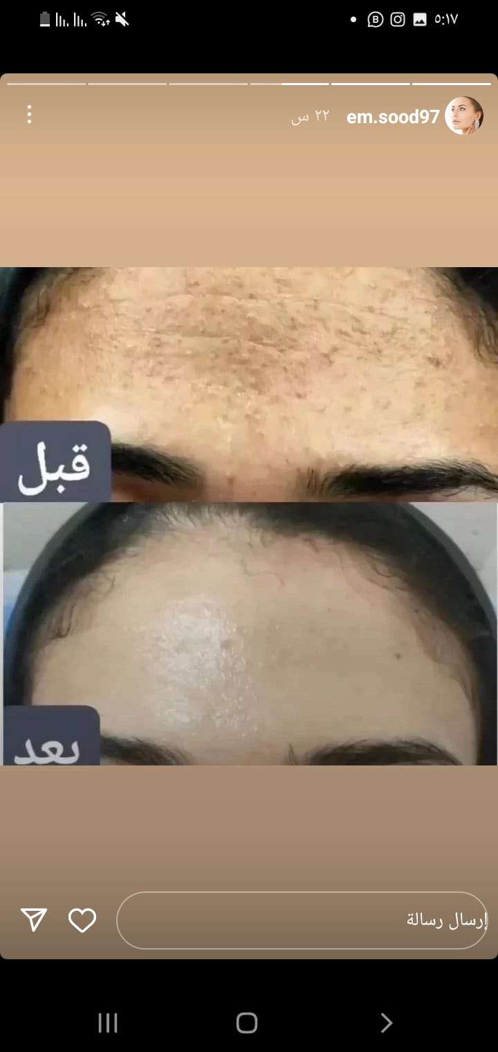 سيرم كولاجين بالدهب