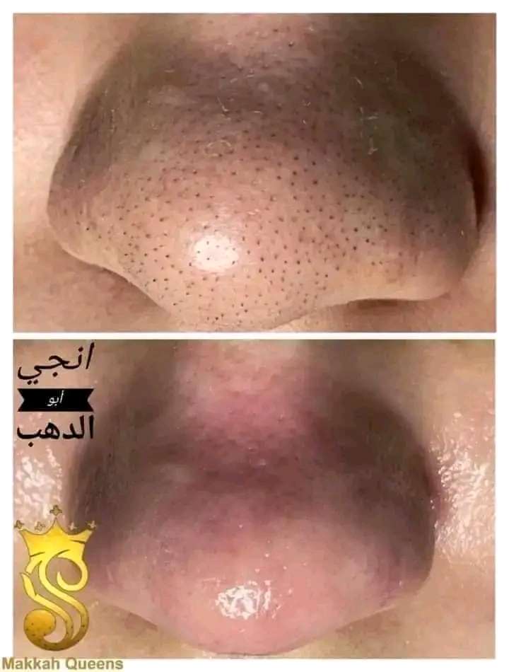 اسكراب مكه بالبندق والشيا