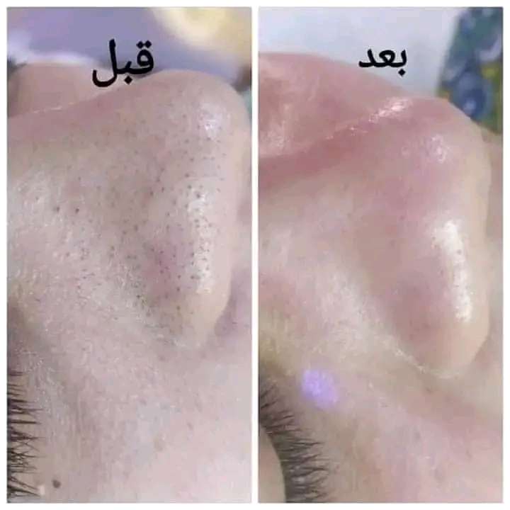 اسكراب مكه بالبندق والشيا