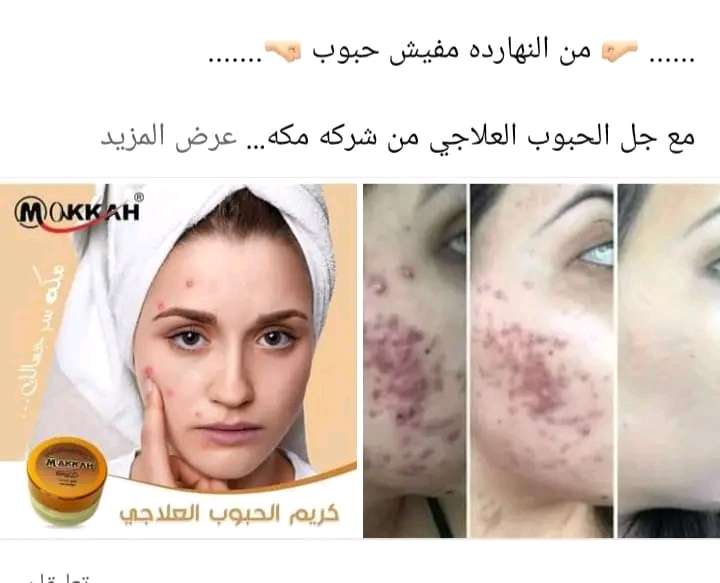 كريم الحبوب وجل الحبوب