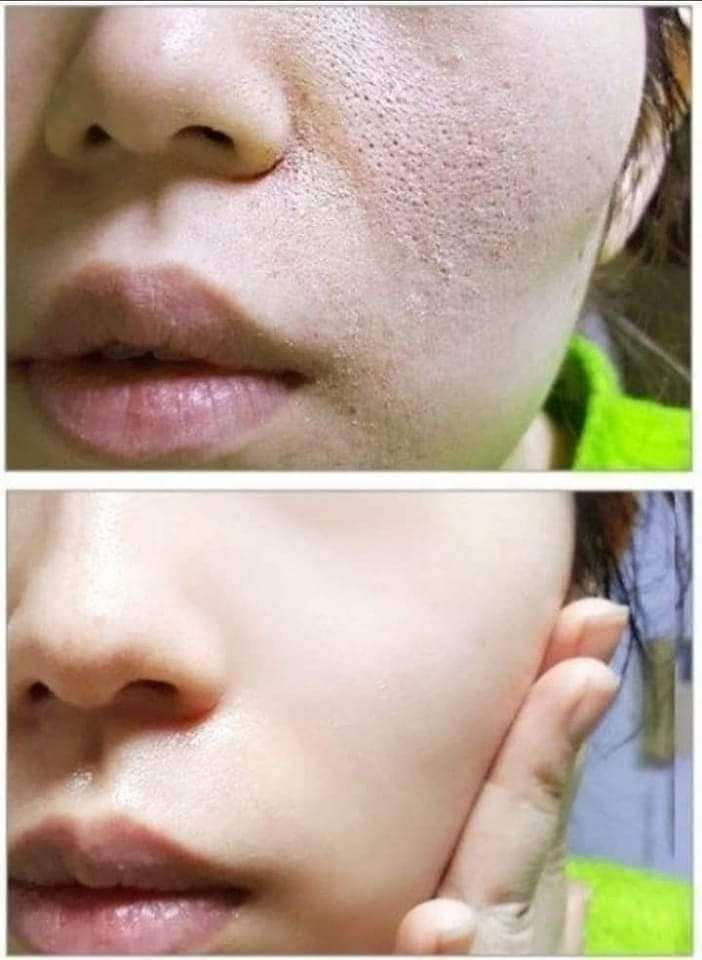 اسكراب مكه بالبندق والشيا