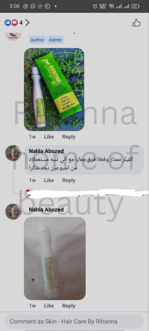 فيلر لعلاج هالات العين