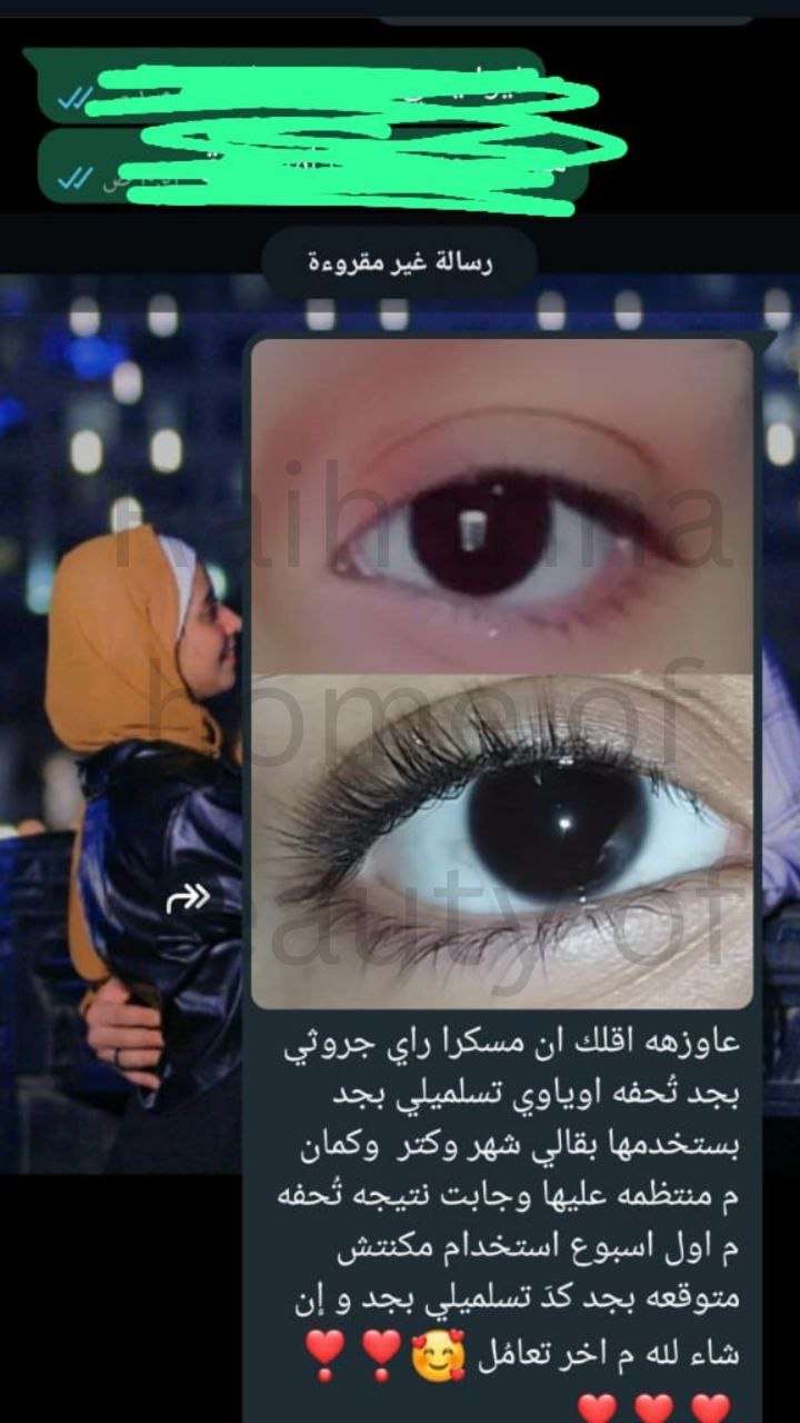 راي جروثي مكثف للحواجب