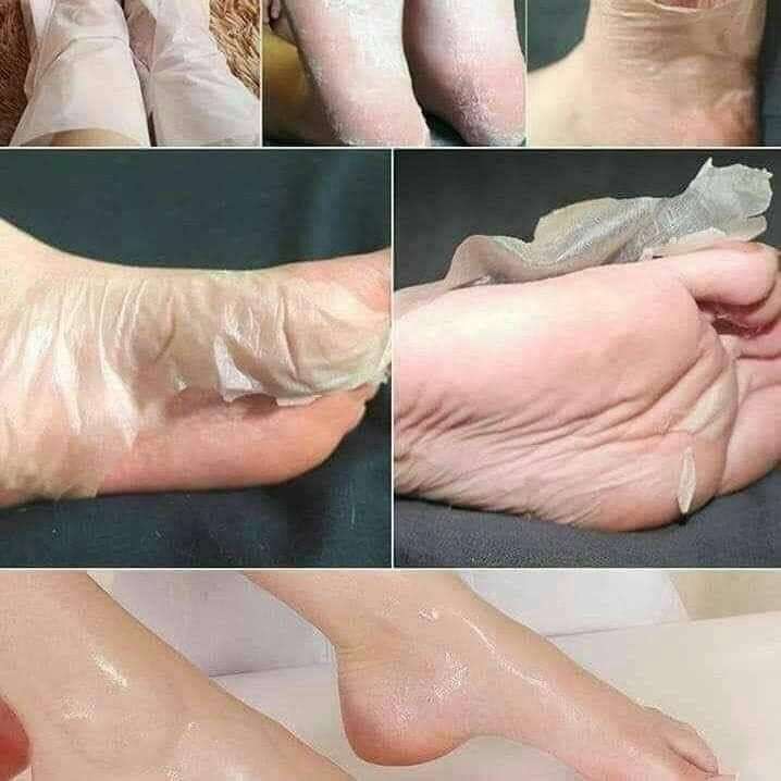 ماسك تقشير القدمين الكوري