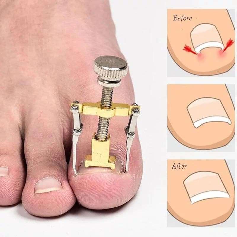اداه تصحيح الاظافر