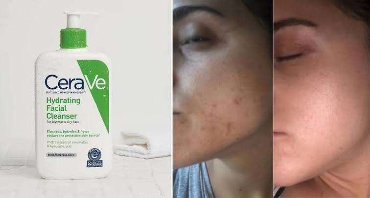 Cerave Hydrating cleanser normal 236 ml