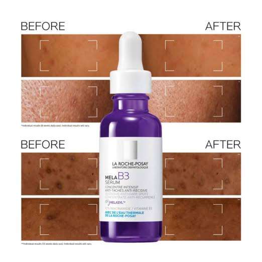 La Roche posay mela B3 Serum 30 nl