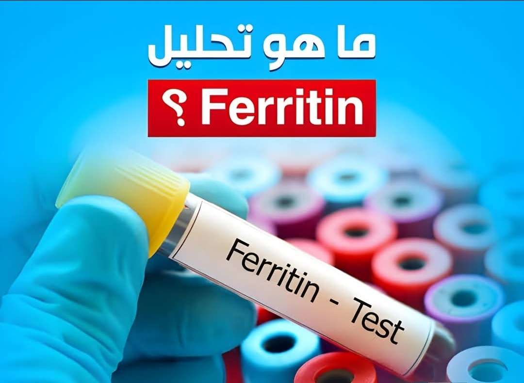 تحليل نسبة صفايح الحديد بالدم