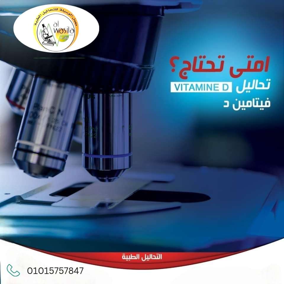 تحليل نسبة فيتامين د بالدم