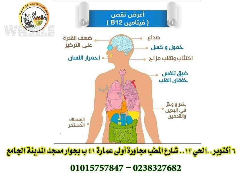تحليل نسبة فيتامين B12 بالدم