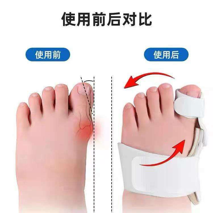 مصحح اصابع القدم