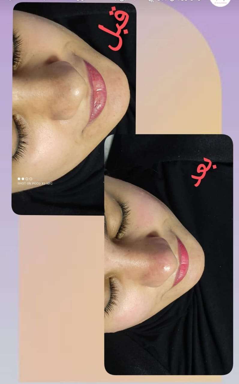 خدمات تجميل