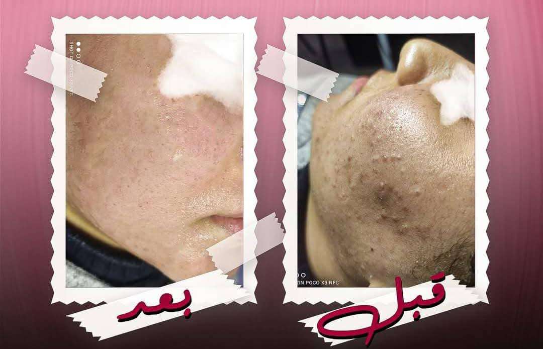 خدمات تجميل