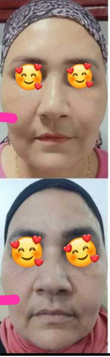 خدمات تجميل