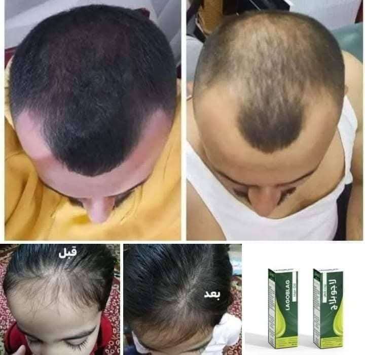 لاجو بلاج طبيعي 100 في 100