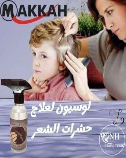 لوشن  حشرات الشعر