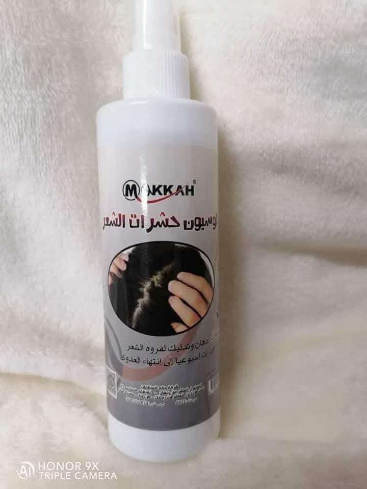 لوشن  حشرات الشعر
