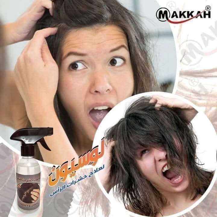 لوشن  حشرات الشعر