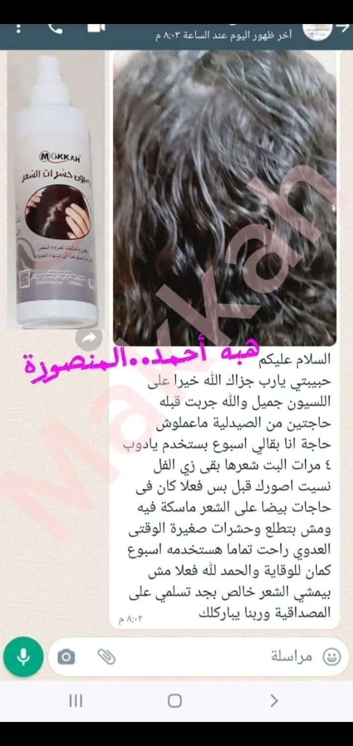 لوشن  حشرات الشعر