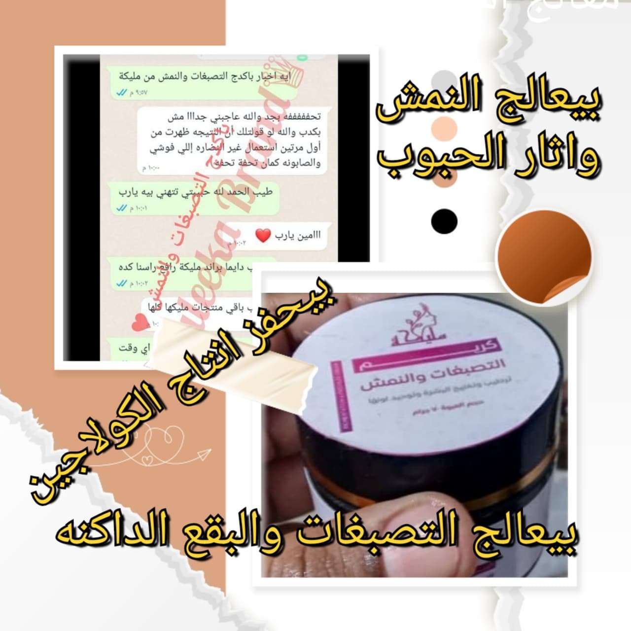 كريم التصبغات والنمش