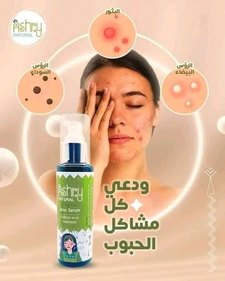 سيرم حب الشباب
