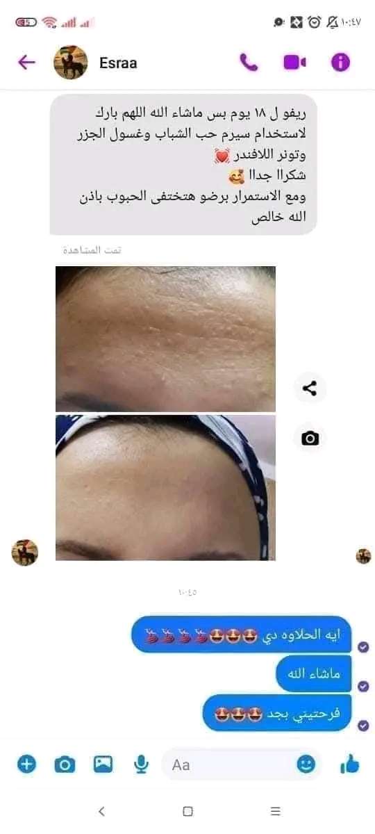 سيرم حب الشباب