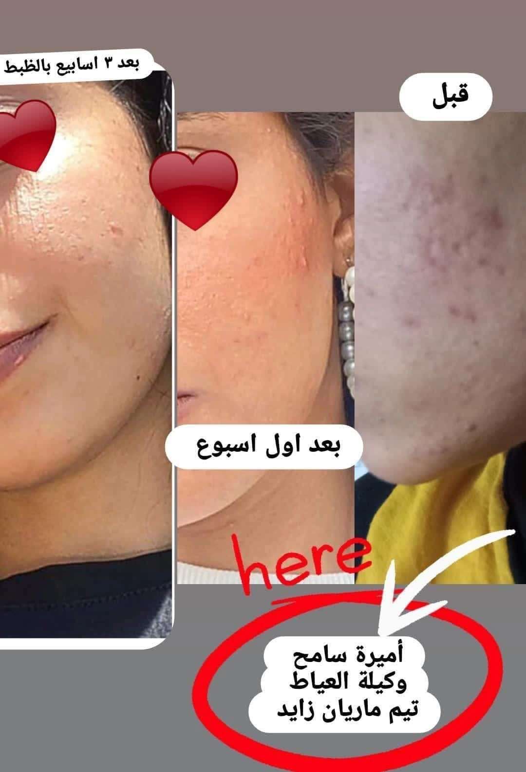 ماسه الحبوب