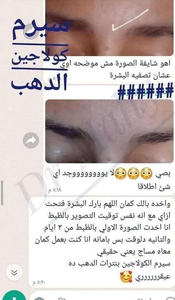 سيرم كولاجين الذهب