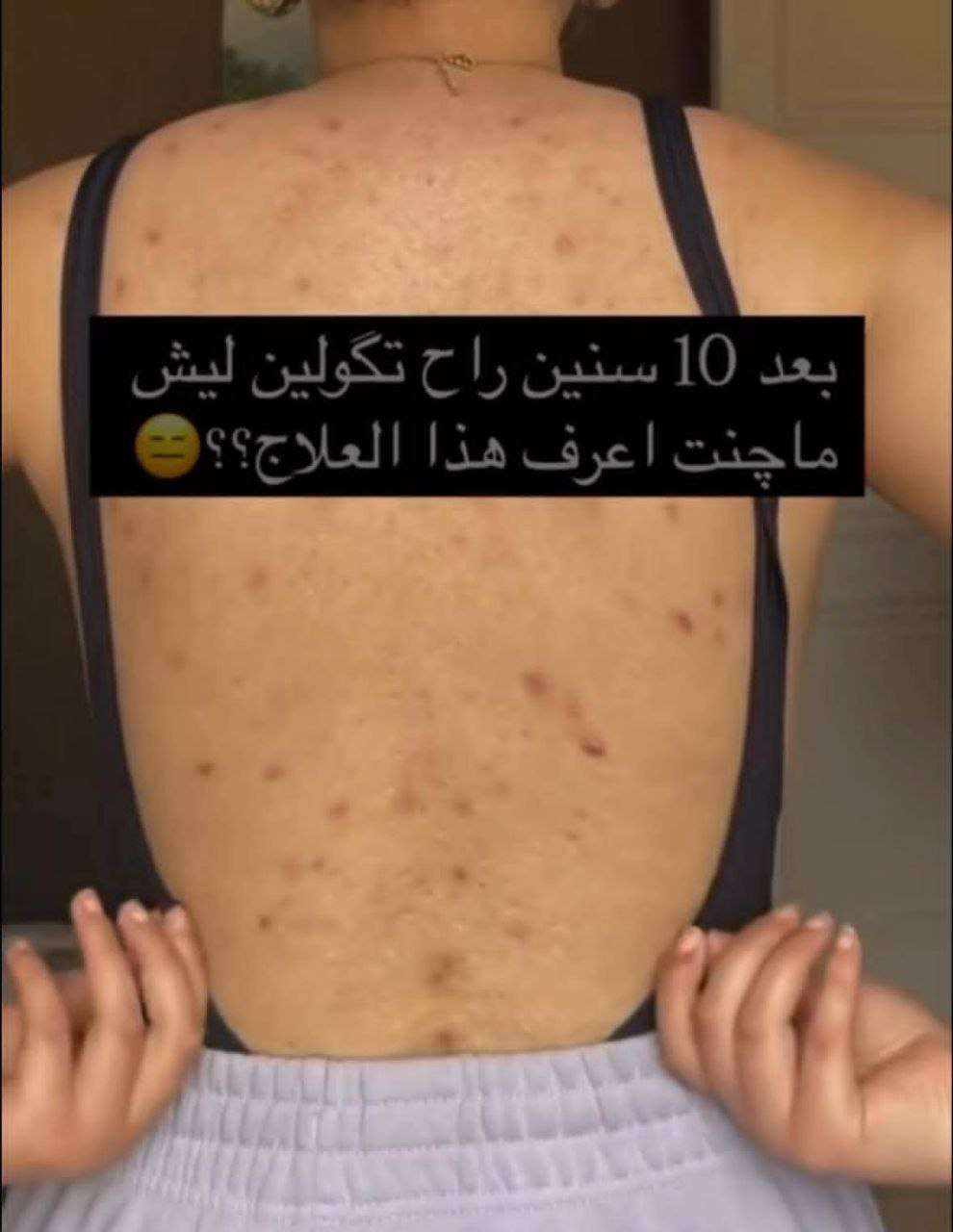 بانوكسيل