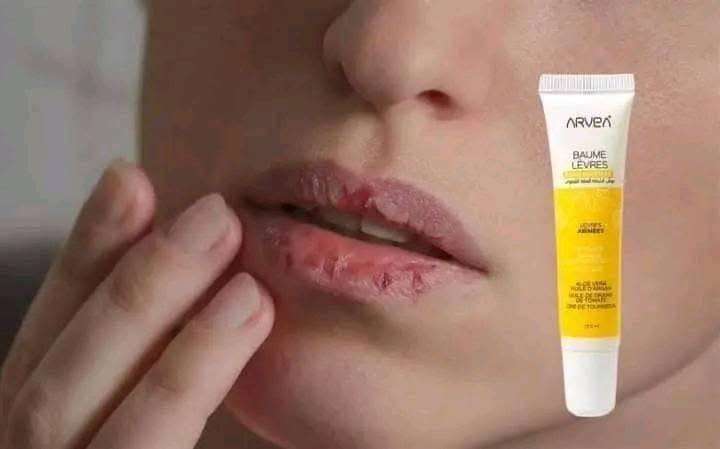 مرطب الشفاة العناية القصوى