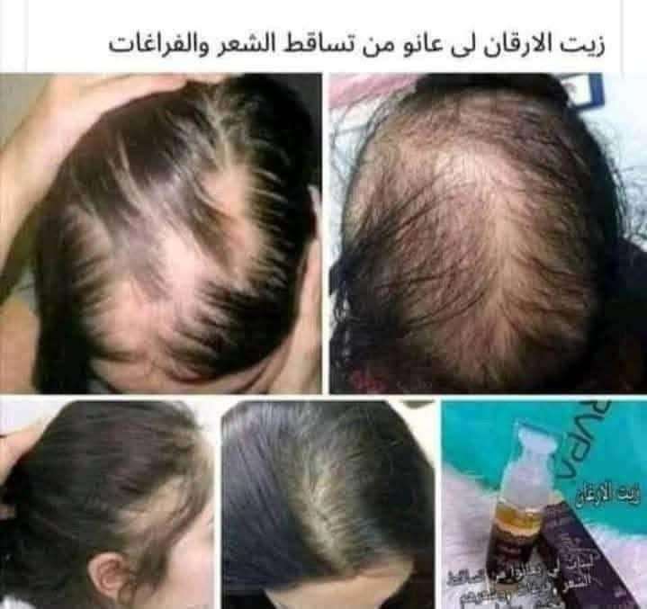 زيت الأرغان الأصلي