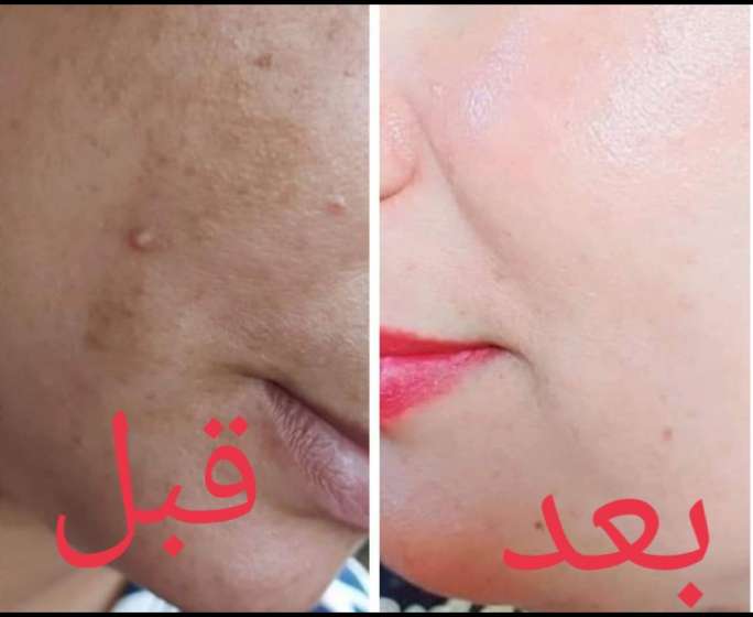 روتين لتفتيح البشره المركز من نوفادج