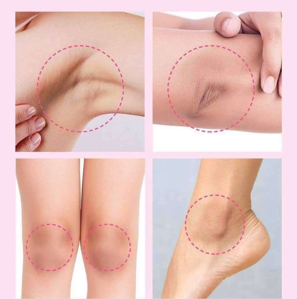 مجموعة التفتيح السحري من care