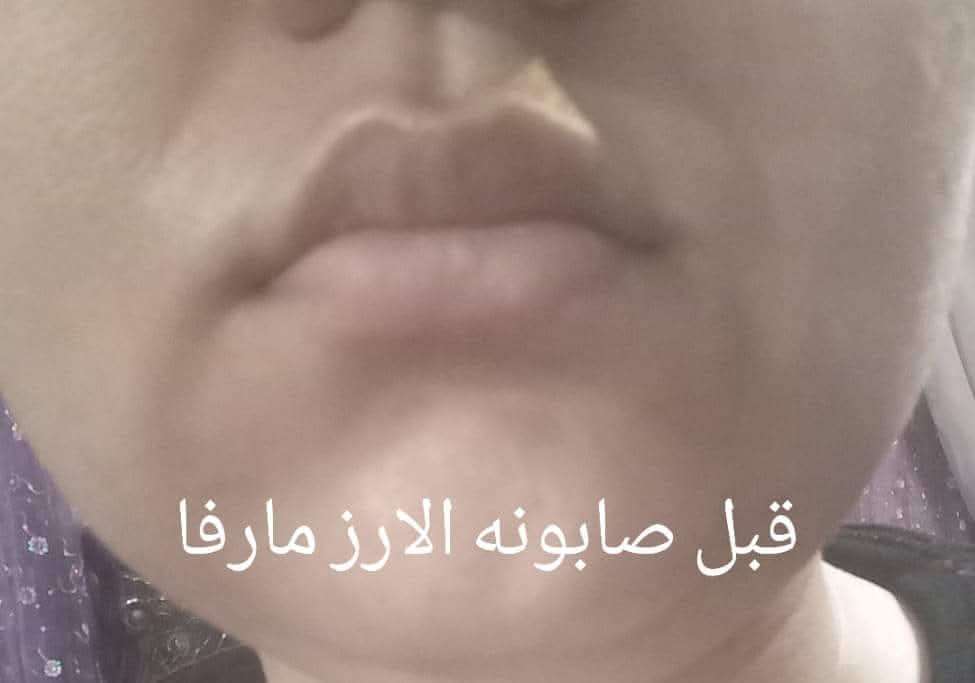 صابونه الارز