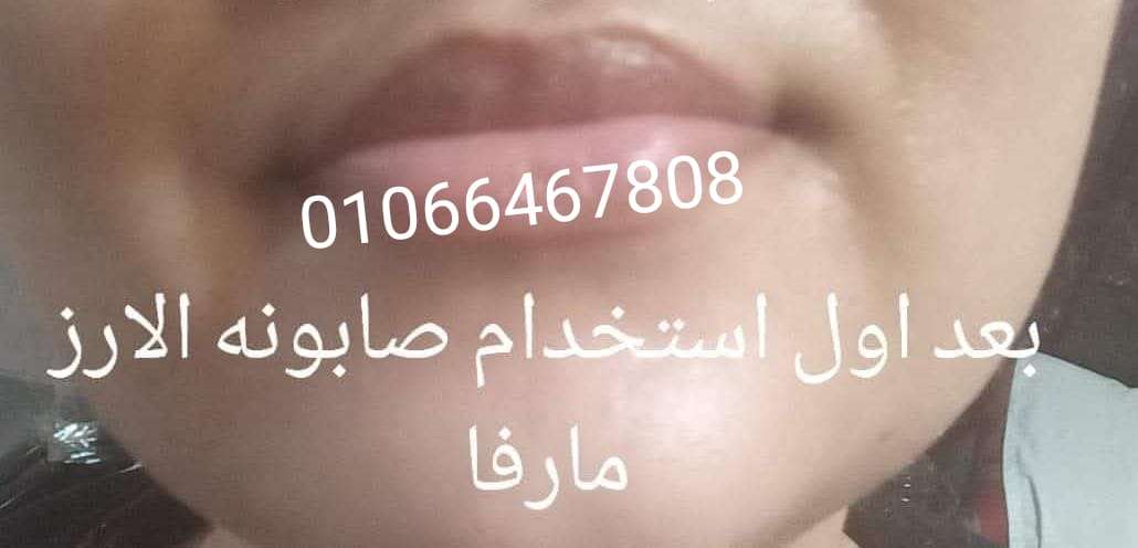 صابونه الارز