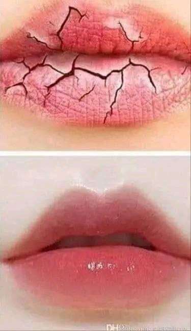 فازلين شفايف