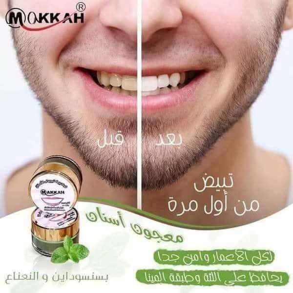 مبيض الاسنان