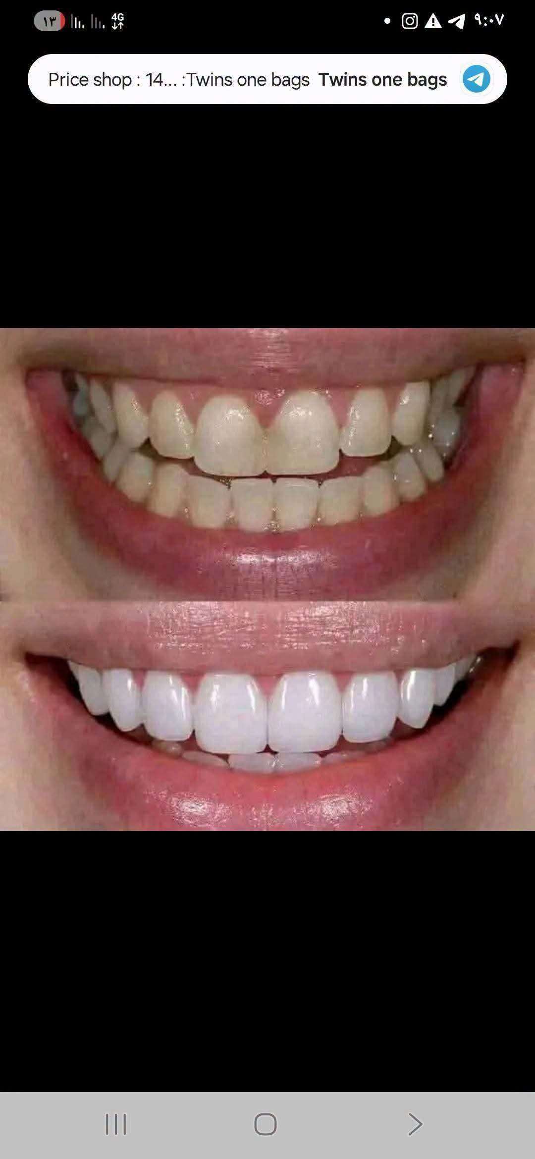 مبيض الاسنان