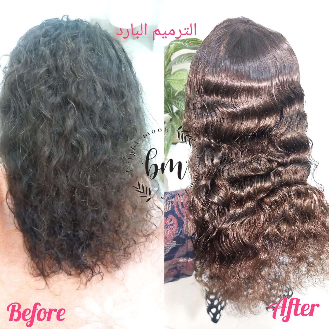 تريتمنت بايوتنك