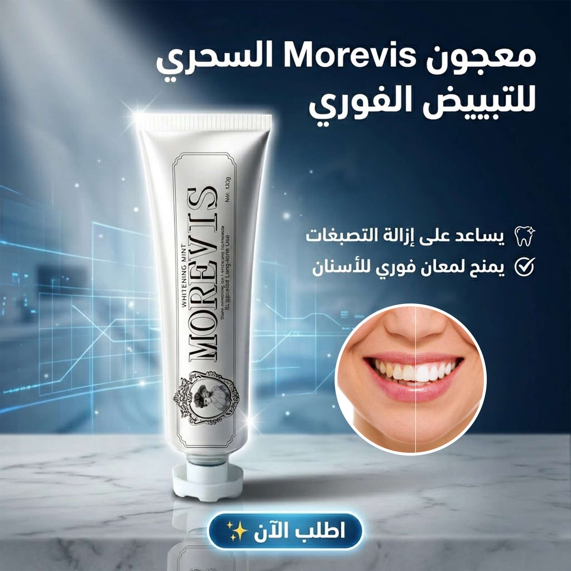 مبيض الاسنان الفورى والسحرى